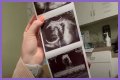 Counting On Alum Joy-Anna Forsyth Updates At 33 Weeks Pregnant