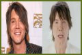 John Rzeznik Facelift | Goo Goo Dolls Frontman Plastic Surgery Before And After