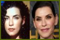 Julianna Margulies Doesn’t Look Natural After Plastic Surgery!